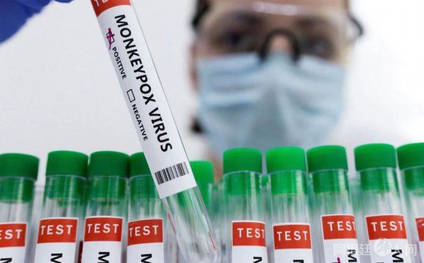 Confirman tres nuevos casos de la viruela del mono en Argentina Confirman tres nuevos casos de la viruela del mono en Argentina