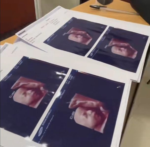 formosa-ecografiajpg