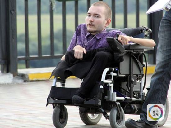 患者现在能活动的仅剩头部