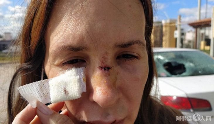 mujer-agredida-cordoba